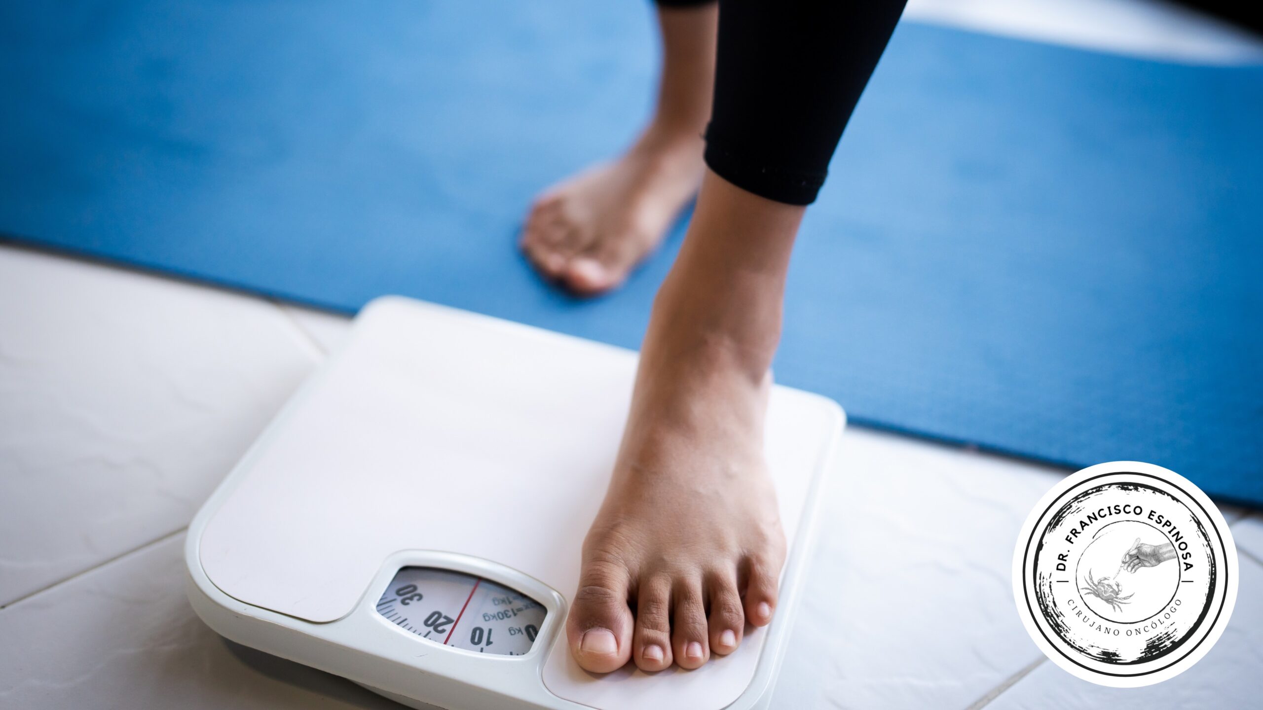 Obesidad y riesgo de cáncer Obesidad y riesgo de cáncer
