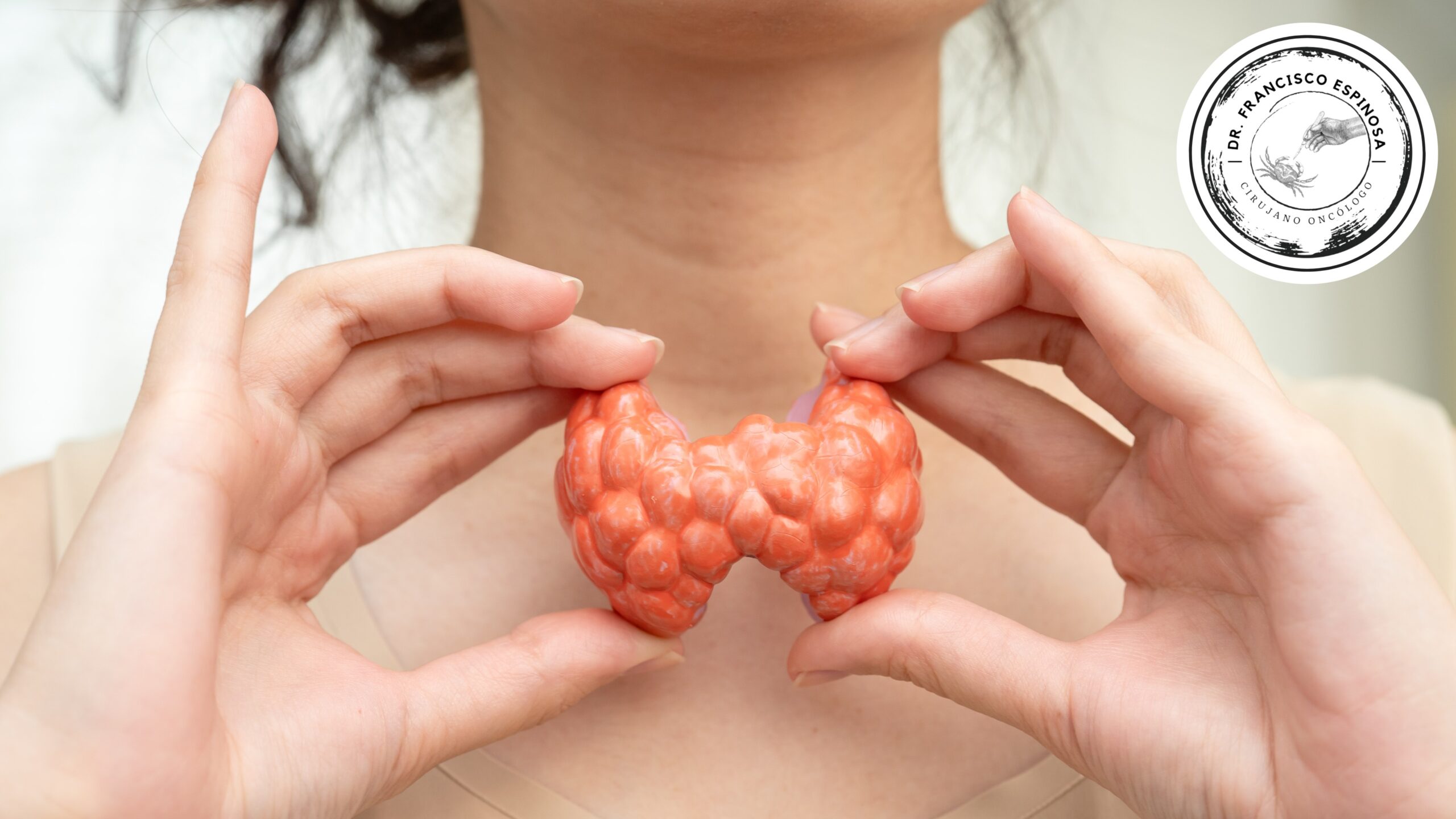 Cáncer de tiroides Cáncer de tiroides
