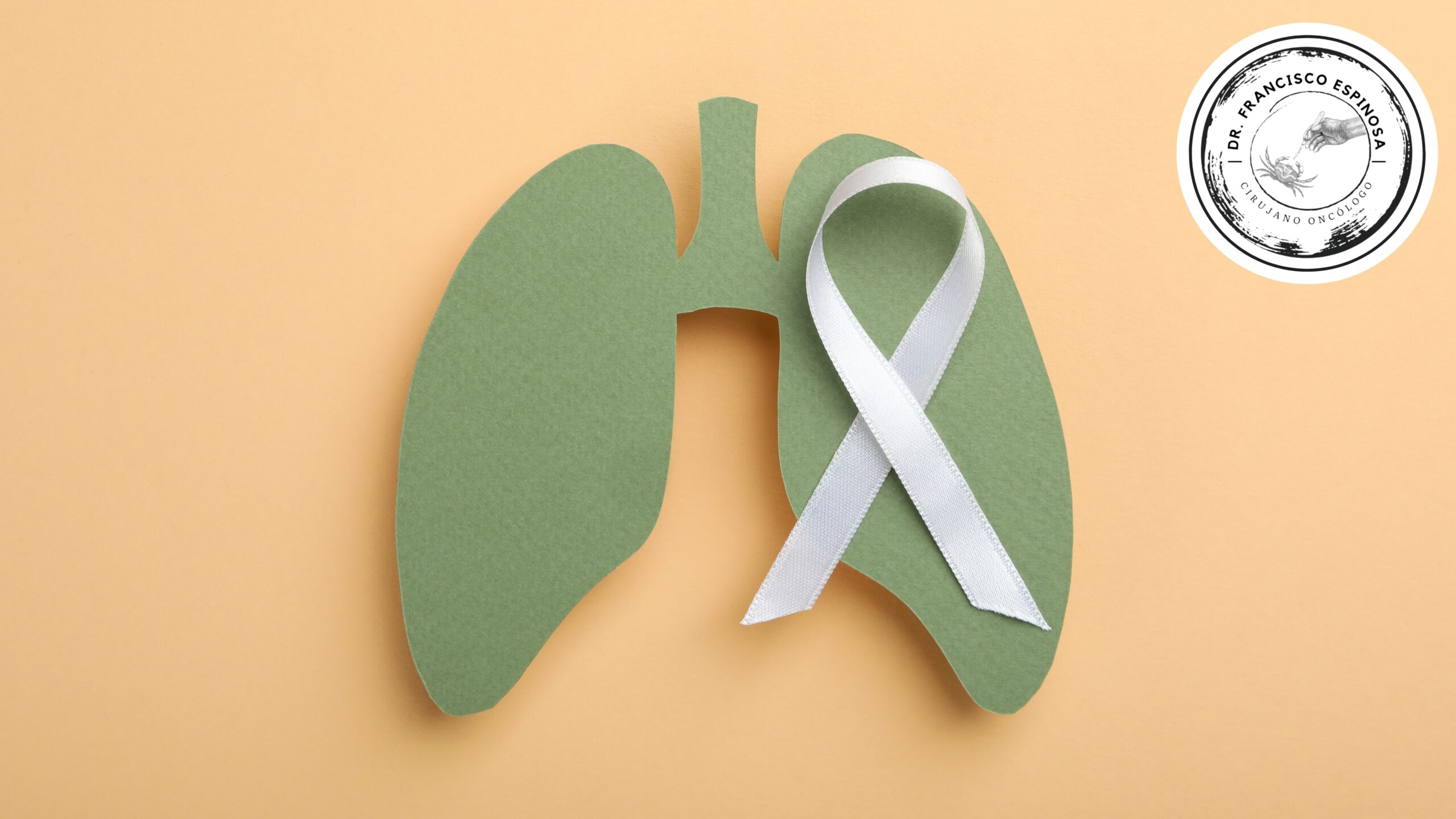 cáncer de pulmón cáncer de pulmón