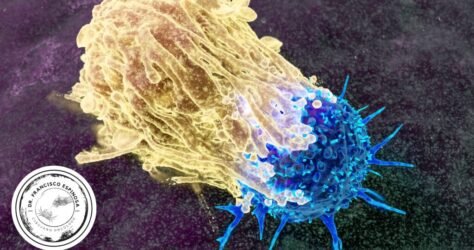 etapas del cáncer etapas del cáncer