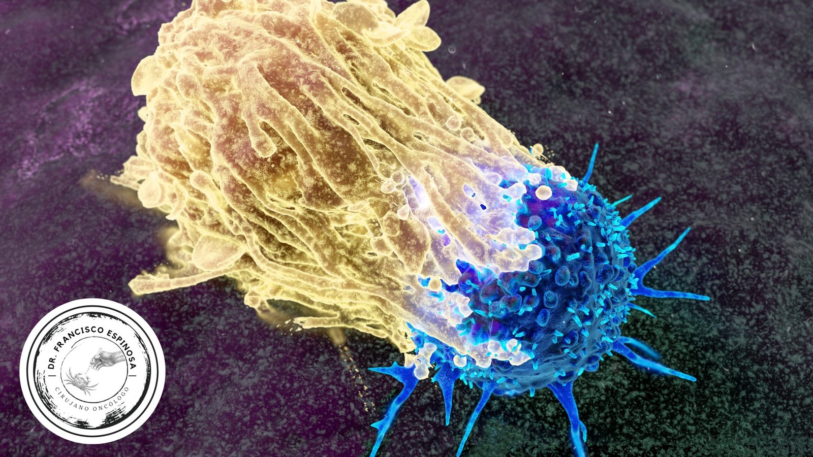 etapas del cáncer etapas del cáncer