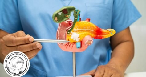 Cáncer de páncreas Cáncer de páncreas